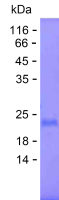 Recombinant Human MAGEB4 Protein(C-His)