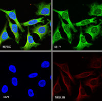 Rabbit anti-STIP1 Recombinant Monoclonal Antibody(S-680-39)