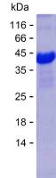 Recombinant Human ALOX15 Protein(N-SUMO & C-His)