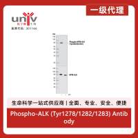 Phospho-ALK (Tyr1278/1282/1283) Antibody