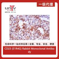 CD23 (E1R4G) Rabbit Monoclonal Antibody