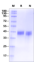 Recombinant Human CD38 Protein(His Tag)