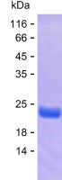 Recombinant Human RASSF8 Protein(C-His)