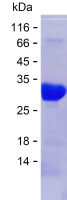 Recombinant Human EIF4EBP2 Protein(N-SUMO & C-His)