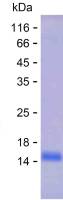 Recombinant Human CDIN1 Protein(C-His)