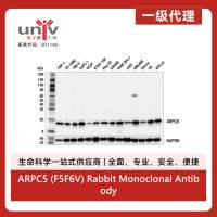 ARPC5 (F5F6V) Rabbit Monoclonal Antibody