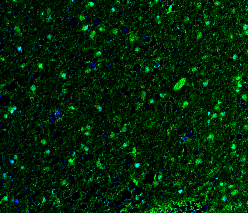 Goat anti-S100B Polyclonal Antibody产品图