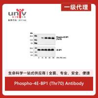 Phospho-4E-BP1 (Thr70) Antibody