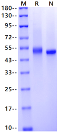 Recombinant Human CD5 Protein(His Tag)产品图