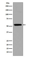 Rabbit anti-Acetyl-p53(Lys370) Polyclonal Antibody
