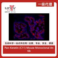 Pan-Keratin (C11) Mouse Monoclonal Antibody (Alexa Fluor<sup>®</sup> 555 Conjugate)