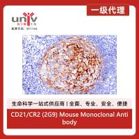 CD21/CR2 (2G9) Mouse Monoclonal Antibody