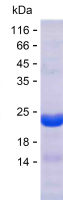 Recombinant Human BLTP3A Protein(C-His)