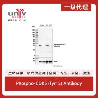 Phospho-CDK5 (Tyr15) Antibody