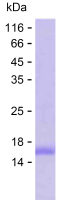 Recombinant Human PKD1 Protein(C-His)