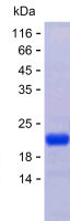 Recombinant Human CEP72 Protein(C-His)