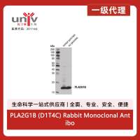PLA2G1B (D1T4C) Rabbit Monoclonal Antibody