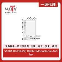 S100A10 (F9U2Z) Rabbit Monoclonal Antibody