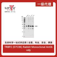 TRBP2 (D7C8K) Rabbit Monoclonal Antibody