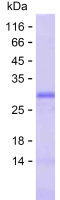Recombinant Human NRP2 Protein(C-His)