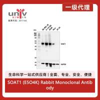 SOAT1 (E5O4K) Rabbit Monoclonal Antibody