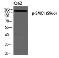Rabbit anti-Phospho-SMC1(Ser966) Polyclonal Antibody