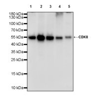 Rabbit anti-CDK8 Recombinant Monoclonal Antibody(S-1627-70)