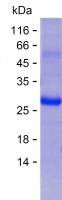 Recombinant Human BIVM Protein(C-His)