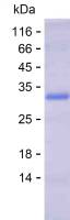 Recombinant Human PARP9 Protein(N-SUMO & C-His)