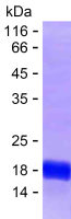 Recombinant Human CDADC1 Protein(C-His)
