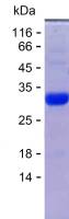 Recombinant Human LBP Protein(N-SUMO & C-His)