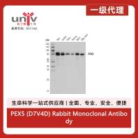 PEX5 (D7V4D) Rabbit Monoclonal Antibody