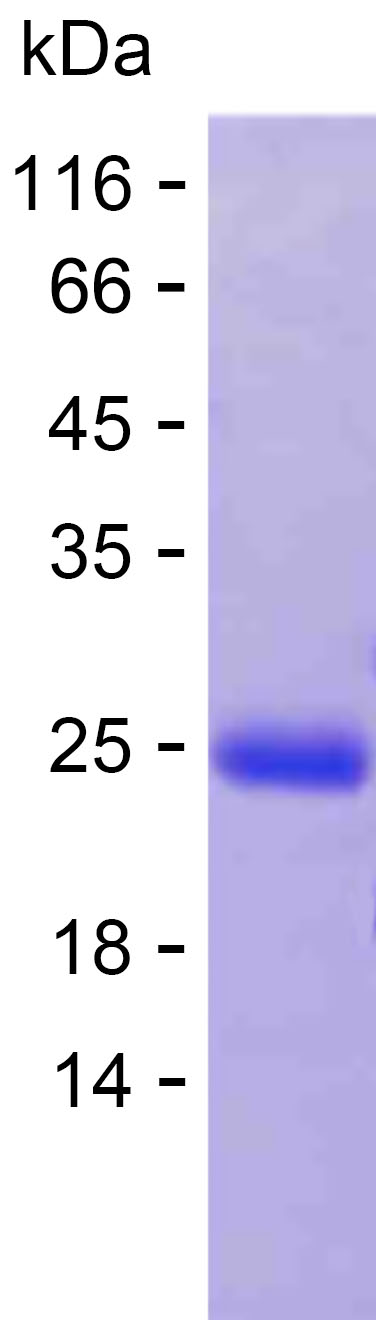 Recombinant Human VPS72 Protein(C-His)产品图