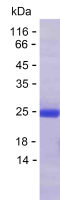 Recombinant Human MSL3 Protein(C-His)