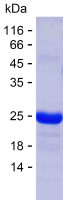 Recombinant Human CFAP99 Protein(C-His)