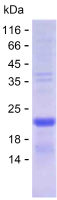 Recombinant Human ATP8B2 Protein(C-His)