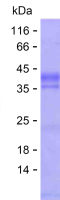 Recombinant Human PRDM4 Protein(C-His)