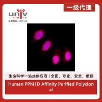 Human PPM1D Affinity Purified Polyclonal Ab (100 UG)