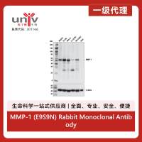 MMP-1 (E9S9N) Rabbit Monoclonal Antibody