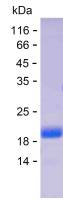 Recombinant Human ANP32E Protein(C-His)