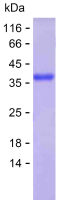 Recombinant Human GNPTAB Protein(C-His)