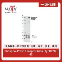Phospho-PDGF Receptor beta (Tyr1009) (42F9) Rabbit Monoclonal Antibody