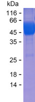 Recombinant Human SLC22A10 Protein(C-hFc & C-His)