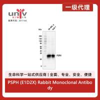 PSPH (E1D2X) Rabbit Monoclonal Antibody