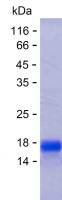 Recombinant Human TRMT13 Protein(C-His)