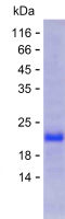 Recombinant Human C1GALT1 Protein(C-His)