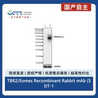TBR2/Eomes Recombinant Rabbit mAb (SDT-1101-231)