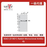 SGK3 (D18D1) Rabbit Monoclonal Antibody