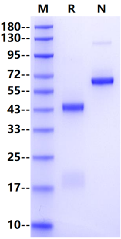 Recombinant HRSV HRSVA(strain A2) Post-fusion glycoprotein F0 Protein(His Tag)产品图