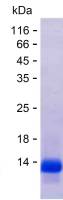 Recombinant Human LRP5L Protein(C-His)
